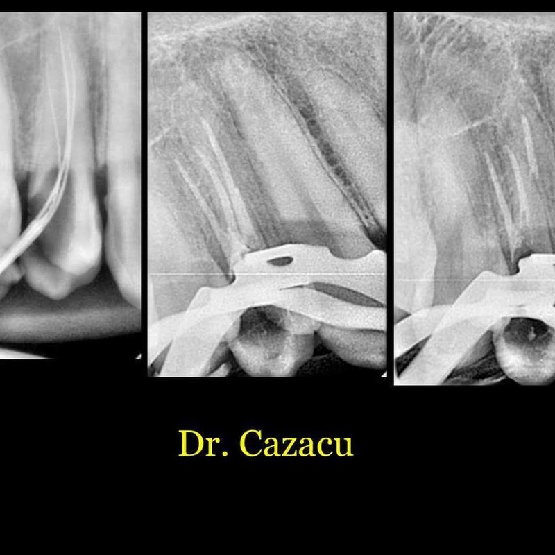 Dr. Cazacu Stomatologie CNC Dental ART